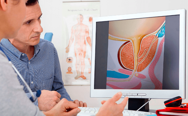 Diagnosis sa prostatitis